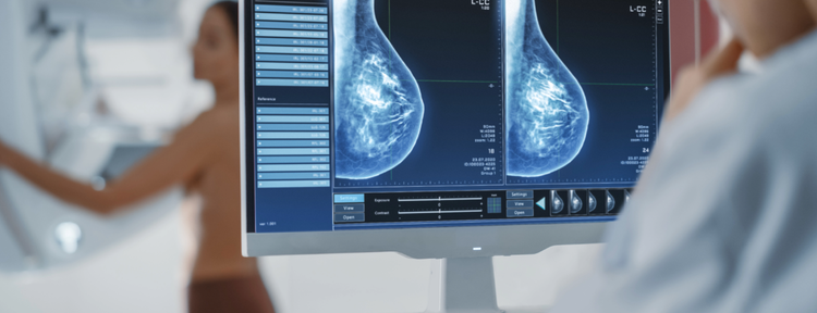 Diagnóstico del cáncer de mama en etapas tempranas