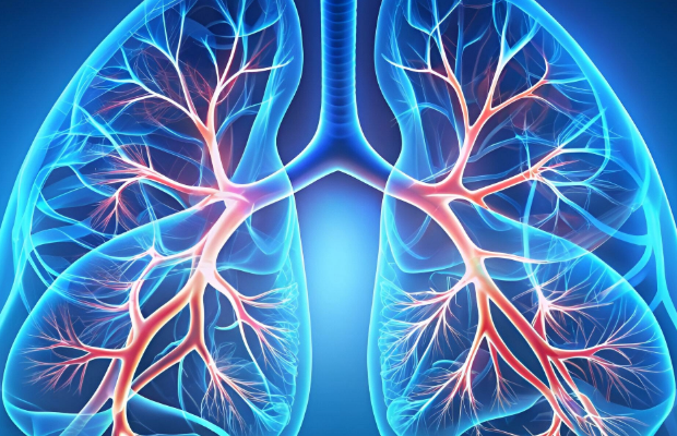 Cáncer de Pulmón