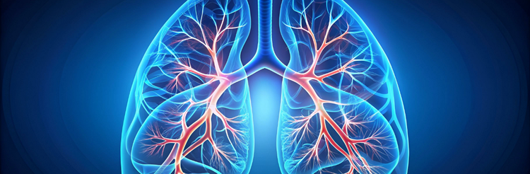 Cáncer de Pulmón